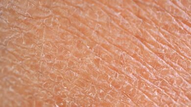 Why Your Skin is Dry